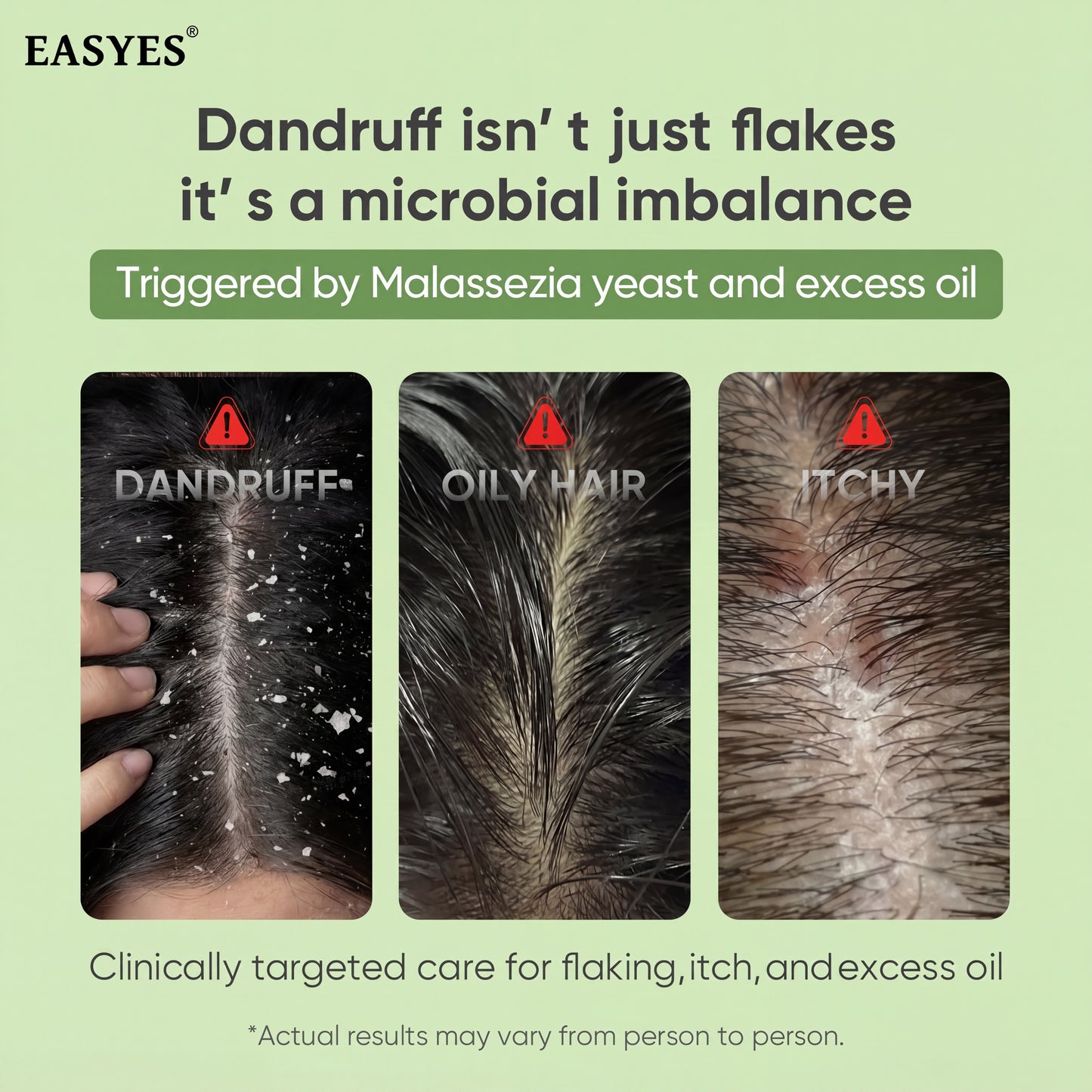EASYES Anti-Hair Loss Shampoo