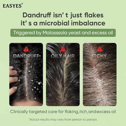 EASYES Anti-Hair Loss Shampoo