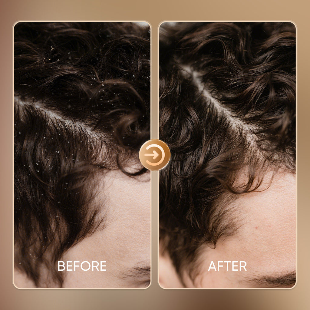 Easyes Anti-Dandruff And Anti-Hair Thinning Shampoo