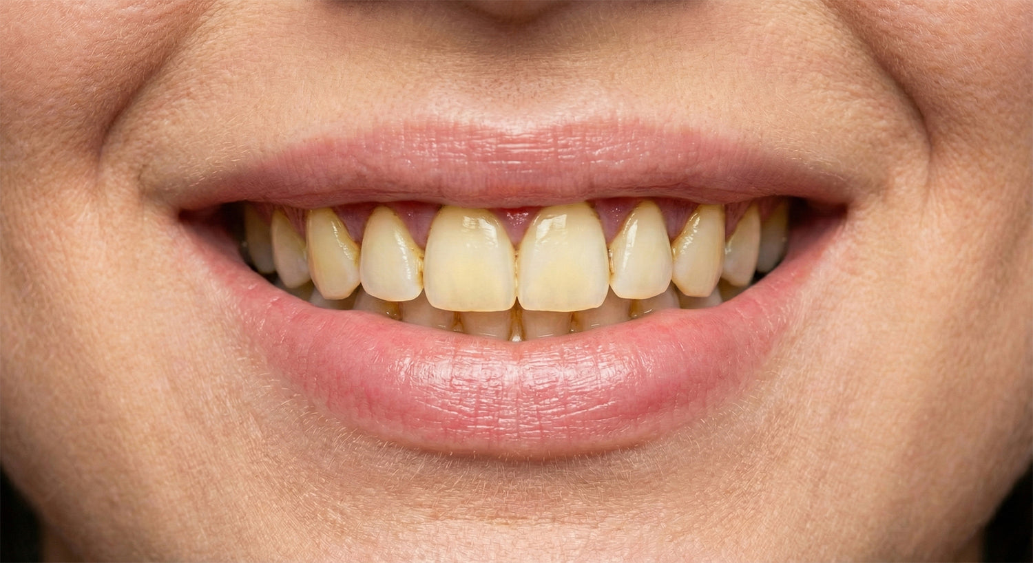 image comparison before